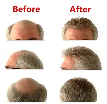 BIO bazės priekiniai nėriniai su Odos Mazgas arba Vloop Plaukų Prosthesise ,Gero žmogaus plaukų vyrų toupee,perukai, plaukų pakeitimo