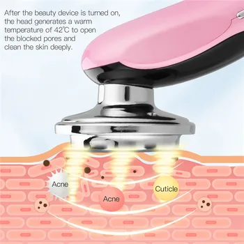 CkeyiN RF LED Fotonų EMS Veido Massager Mezoterapija Electroporation Vibracijos, Odos Atjauninimas, Veido Kėlimo Raukšlių Šalinimas 50