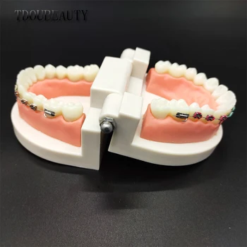 Dantų Ortodontinis Laikiklis Modelis Gydytojas-Paciento Bendravimas Mokymo Modelį Korekcinių Pratybų Modelis Dantų Modelis