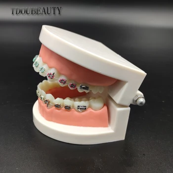 Dantų Ortodontinis Laikiklis Modelis Gydytojas-Paciento Bendravimas Mokymo Modelį Korekcinių Pratybų Modelis Dantų Modelis