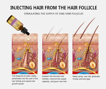 Daugiafunkcinis Galvos odos Gydymo 30ml Marokas eterinio Aliejaus purškimo Gryno Argano Aliejaus Plaukų Augimą Remonto Sausų Pažeistų Plaukų